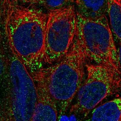 Immunocytochemistry/ Immunofluorescence: PTCD1 Antibody [NBP2-33495]