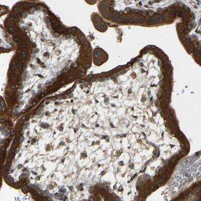 Immunohistochemistry-Paraffin: PTCD1 Antibody [NBP1-81493]
