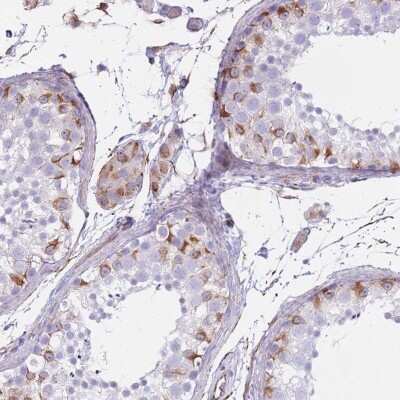 Immunohistochemistry-Paraffin: PTCD1 Antibody [NBP2-33495]
