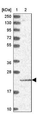 Western Blot: PTCD2 Antibody [NBP1-92303]