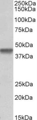 Western Blot: PTCD2 Antibody [NBP2-26175]