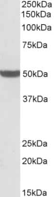 Western Blot: PTCD2 Antibody [NBP2-26176]