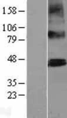 Western Blot: PTCD2 Overexpression Lysate [NBL1-14922]