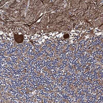 Immunohistochemistry-Paraffin: PTCD3 Antibody [NBP1-84125]