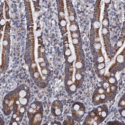 Immunohistochemistry-Paraffin: PTCD3 Antibody [NBP1-84125]