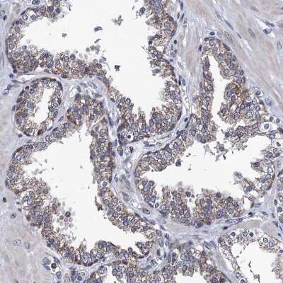 Immunohistochemistry-Paraffin: PTCD3 Antibody [NBP1-84125]