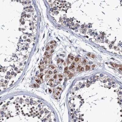 Immunohistochemistry-Paraffin: PTCD3 Antibody [NBP1-84125]