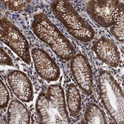 Immunohistochemistry-Paraffin: PTCD3 Antibody [NBP1-84126]