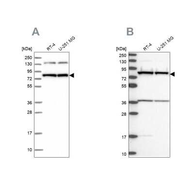 Western Blot: PTCD3 Antibody [NBP1-84125]