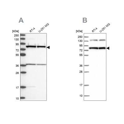 Western Blot: PTCD3 Antibody [NBP1-84126]