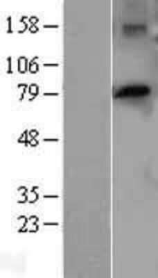 Western Blot: PTCD3 Overexpression Lysate [NBL1-14923]