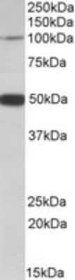 Western Blot: PTCHD1 Antibody [NBP1-52108]