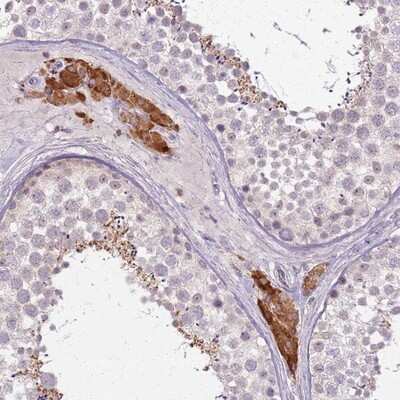 Immunohistochemistry-Paraffin: PTCHD3 Antibody [NBP2-14538]