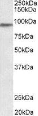 Western Blot: PTCHD3 Antibody [NBP2-27497]