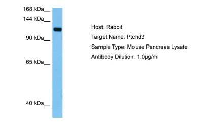 Western Blot: PTCHD3 Antibody [NBP2-85558]