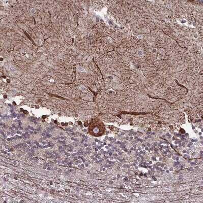 Immunohistochemistry-Paraffin: PTCHD4 Antibody [NBP1-84223]