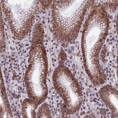 Immunohistochemistry-Paraffin: PTCHD4 Antibody [NBP1-84223]