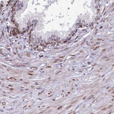 Immunohistochemistry-Paraffin: PTCHD4 Antibody [NBP1-84223]