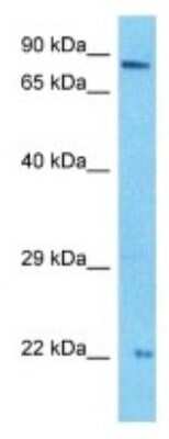 Western Blot: PTCRA Antibody [NBP3-09949]