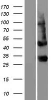 Western Blot: PTCRA Overexpression Lysate [NBP2-05680]