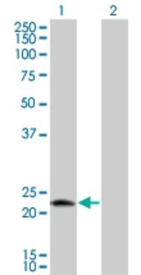 Western Blot: PTD016 Antibody (4H7) [H00051136-M01]