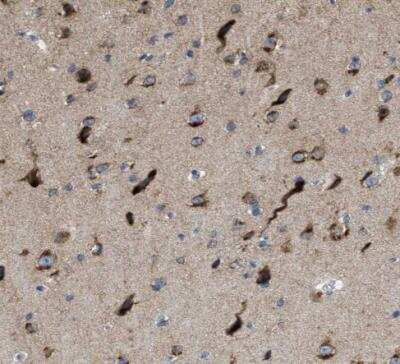 Immunohistochemistry-Paraffin: PTDSS1 Antibody [NBP1-83060]