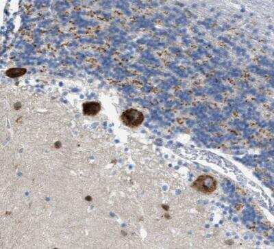 Immunohistochemistry-Paraffin: PTDSS1 Antibody [NBP1-83060]