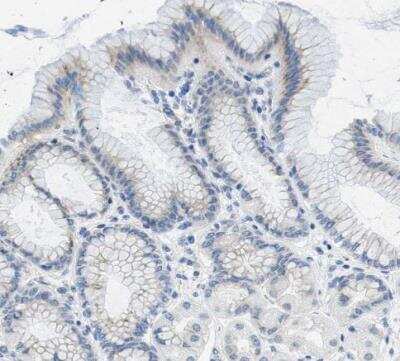 Immunohistochemistry-Paraffin: PTDSS1 Antibody [NBP1-83060]