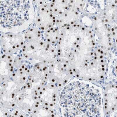 Immunohistochemistry-Paraffin: PTDSS1 Antibody [NBP1-83060]