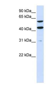 Western Blot: PTDSS1 Antibody [NBP1-59966]