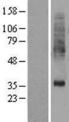 Western Blot: PTDSS1 Overexpression Lysate [NBL1-14925]