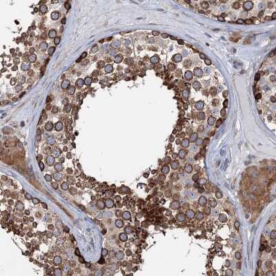 Immunohistochemistry-Paraffin: PTDSS2 Antibody [NBP2-38432]