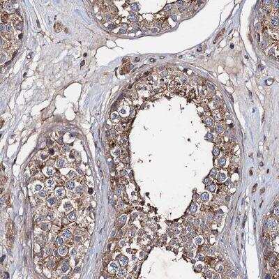 Immunohistochemistry-Paraffin: PTDSS2 Antibody [NBP1-80874]