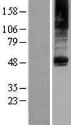 Western Blot: PTDSS2 Overexpression Lysate [NBP2-04397]