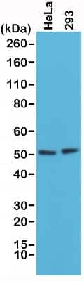 Western Blot: PTEN Antibody (RM265) [NBP2-77408]