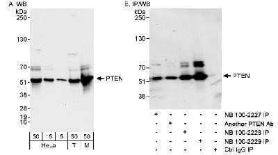 Western Blot: PTEN Antibody [NB100-2229]