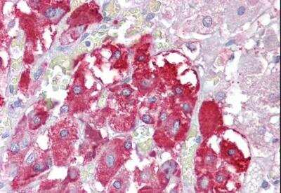 Immunohistochemistry-Paraffin: PTEN2/TPTE Antibody [NB100-41395]