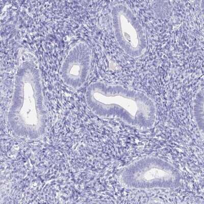 Immunohistochemistry-Paraffin: PTEN2/TPTE Antibody [NBP2-33576]