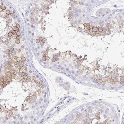 Immunohistochemistry-Paraffin: PTEN2/TPTE Antibody [NBP2-33576]