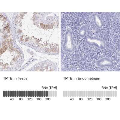 Immunohistochemistry-Paraffin: PTEN2/TPTE Antibody [NBP2-33576]