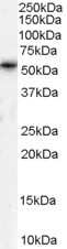 Western Blot: PTEN2/TPTE Antibody [NB100-41395]