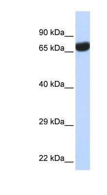 Western Blot: PTEN2/TPTE Antibody [NBP1-58240]