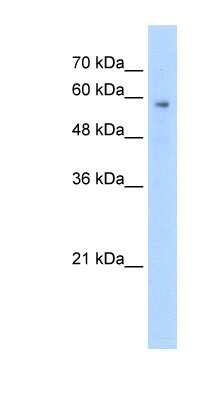 Western Blot: PTEN2/TPTE Antibody [NBP1-58242]