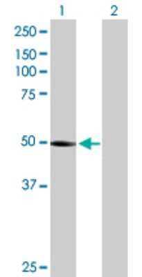 Western Blot: PTENP1 Antibody [H00011191-B01P]