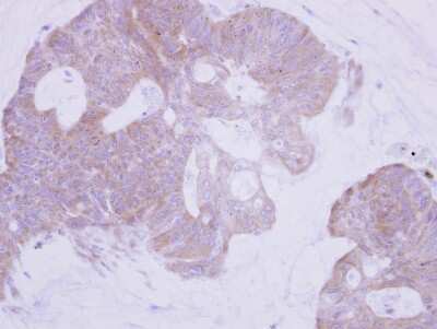 Immunohistochemistry-Paraffin: PTER Antibody [NBP1-32016]