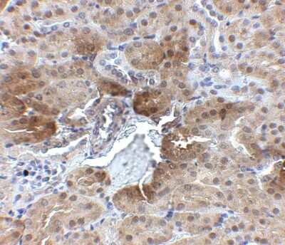 Immunohistochemistry-Paraffin: PTER Antibody - BSA Free [NBP1-77355]