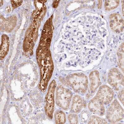 Immunohistochemistry-Paraffin: PTER Antibody [NBP1-86264]