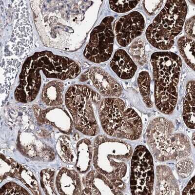 Immunohistochemistry-Paraffin: PTER Antibody [NBP2-38380]