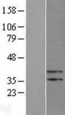 Western Blot: PTER Overexpression Lysate [NBL1-14929]