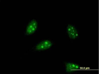 Immunocytochemistry/ Immunofluorescence: PTF1A Antibody (1A2) [H00256297-M05]